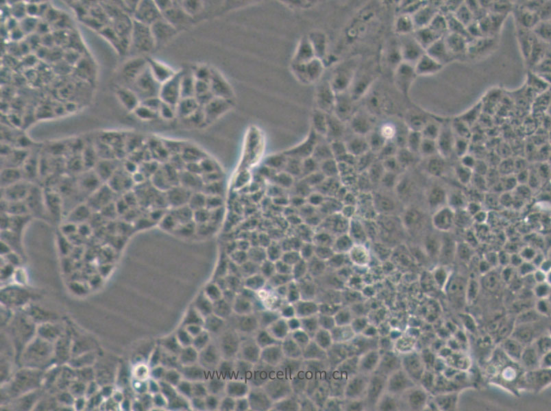 MKN74 (人胃癌細胞) (STR鑒定正確)