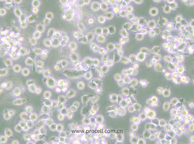 ARH-77 (人漿細(xì)胞白血病) (STR鑒定正確)