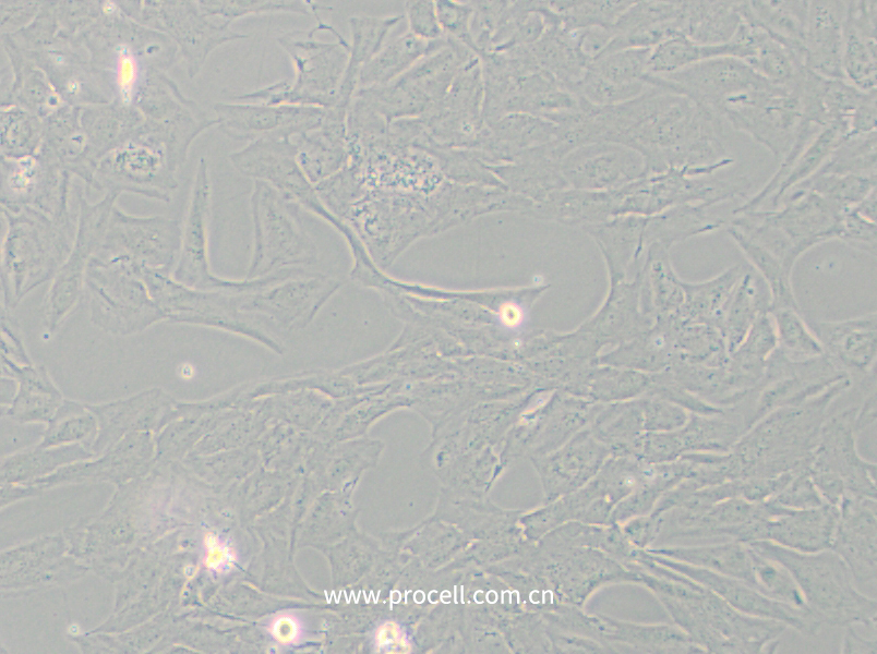 NCI-H196 (人小細(xì)胞肺癌細(xì)胞) (STR鑒定正確)