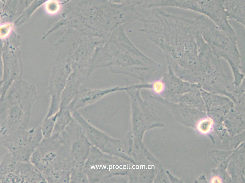 NCI-H196 (人小細(xì)胞肺癌細(xì)胞) (STR鑒定正確)