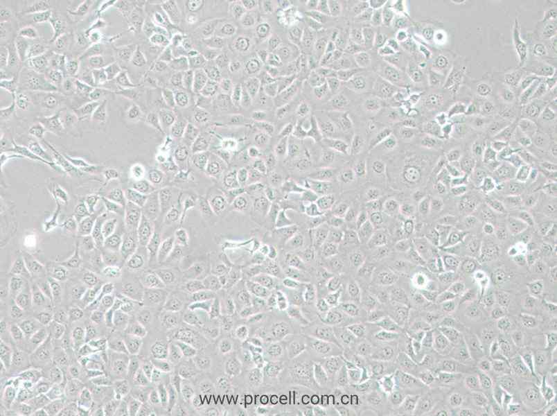 HCE-T (人角膜上皮細(xì)胞) (STR鑒定正確)