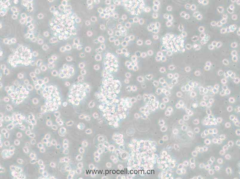 SU-DHL-6 (人彌散性組織淋巴瘤細(xì)胞) (STR鑒定正確)