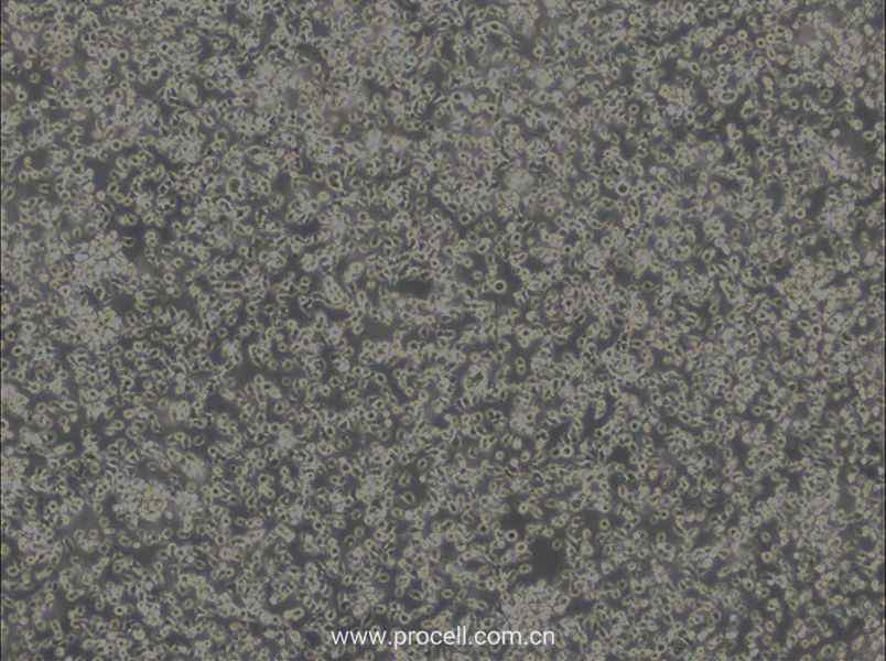 MEC-1 (人慢性B細(xì)胞白血病細(xì)胞) (STR鑒定正確)