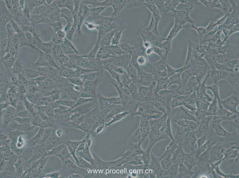 HTR-8-Svneo (人絨毛膜滋養(yǎng)層細胞) (STR鑒定正確)