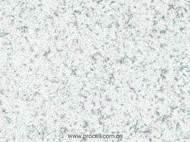 ARD (人多發(fā)性骨髓瘤細胞) (STR鑒定正確)