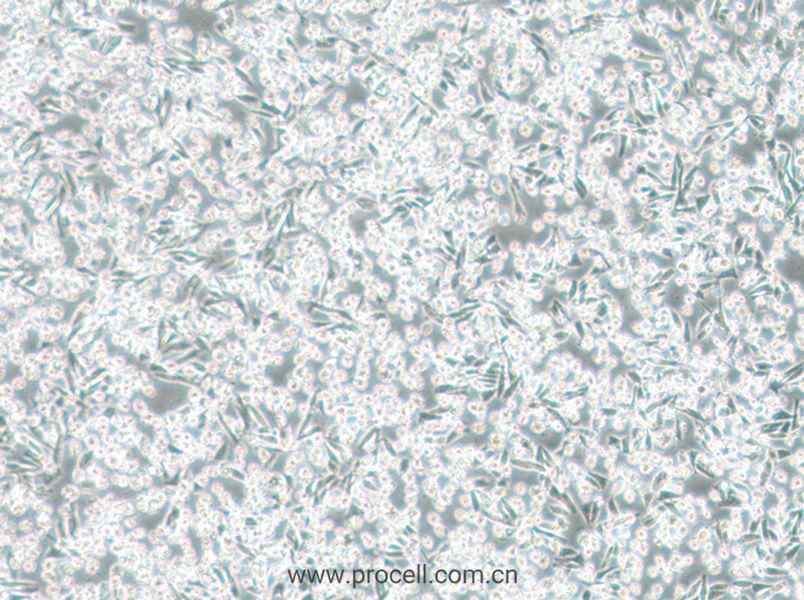 ARD (人多發(fā)性骨髓瘤細(xì)胞) (STR鑒定正確)
