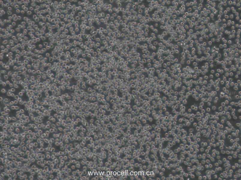 Mino (人外周血套細(xì)胞淋巴瘤細(xì)胞) (STR鑒定正確)