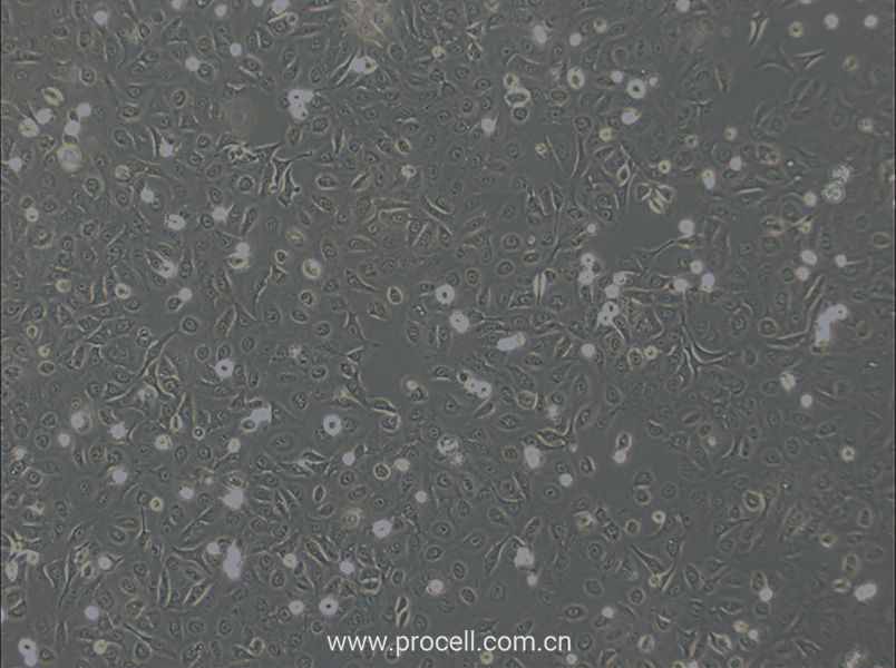 OVCA429 (人卵巢癌細胞) (STR鑒定正確)