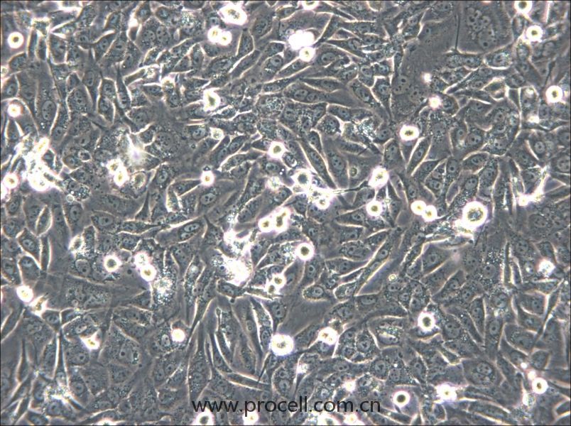 HS-5 (人骨髓基質(zhì)細胞) (STR鑒定正確)