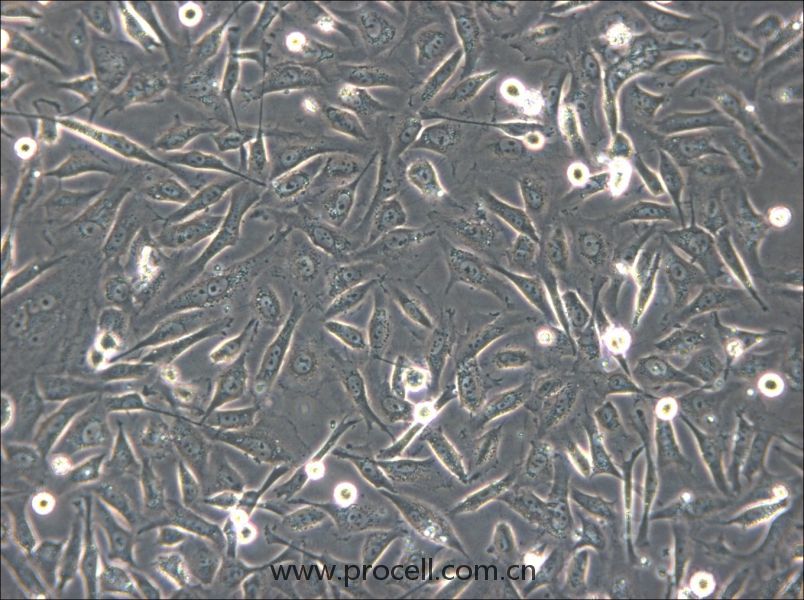 HS-5 (人骨髓基質(zhì)細胞) (STR鑒定正確)