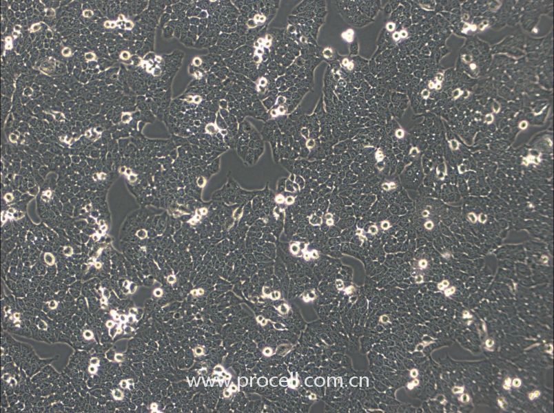 WSU-HN30 (人口腔鱗狀細(xì)胞) (STR鑒定正確)