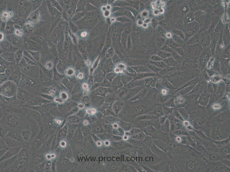 Panc 03.27 (人胰腺癌細(xì)胞) (STR鑒定正確)