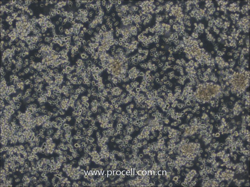 HCC38 BL (人淋巴母細胞(EBV 轉化)) (STR鑒定正確)