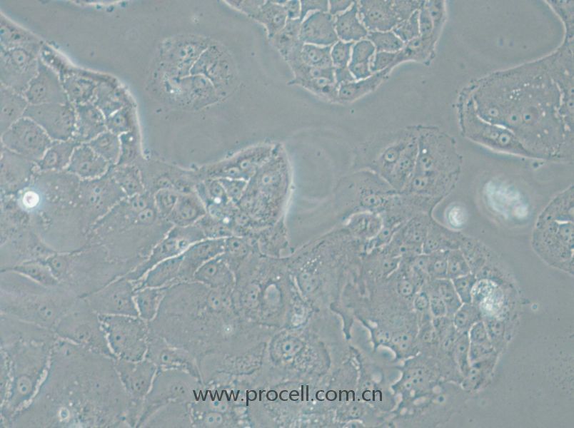 SU.86.86 (人胰腺導(dǎo)管癌細(xì)胞) (STR鑒定正確)