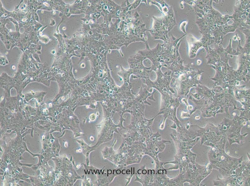 UPCI-SCC-090(人舌鱗癌細(xì)胞)(STR鑒定正確)