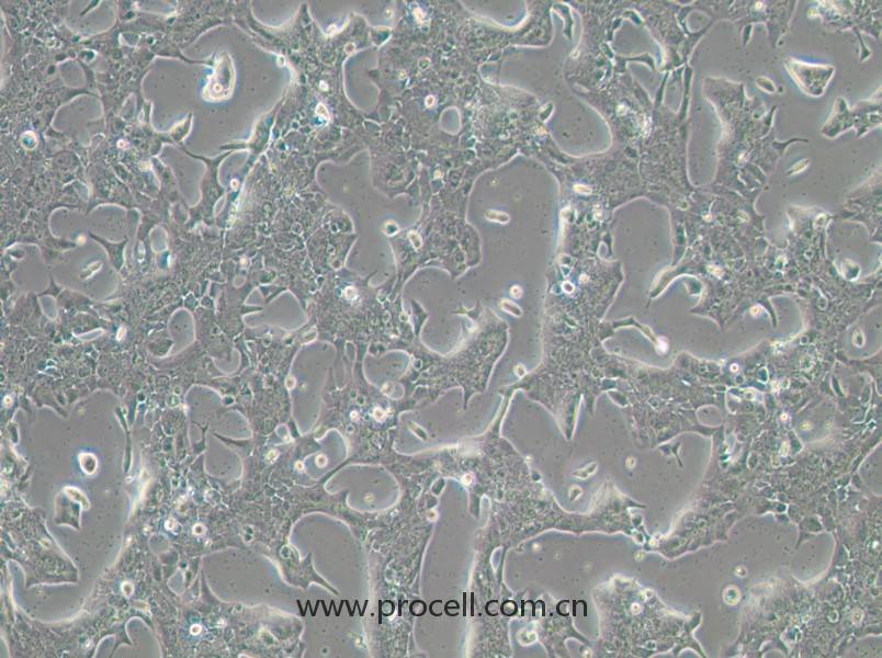 UPCI-SCC-090(人舌鱗癌細(xì)胞)(STR鑒定正確)