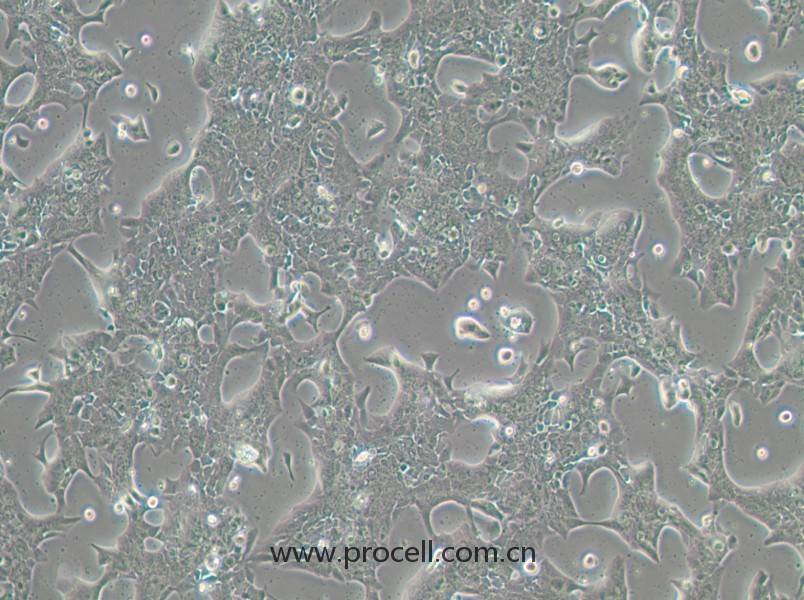 UPCI-SCC-090(人舌鱗癌細(xì)胞)(STR鑒定正確)