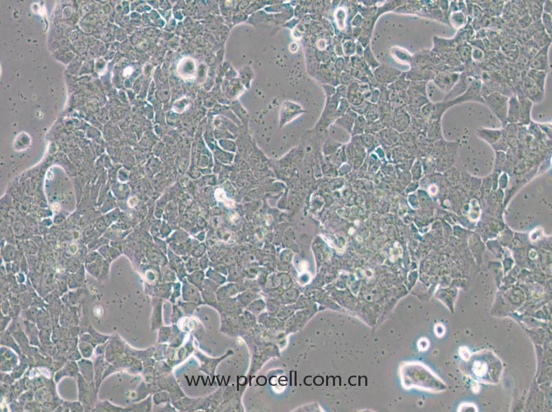 UPCI-SCC-090(人舌鱗癌細(xì)胞)(STR鑒定正確)