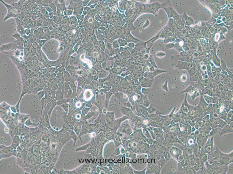 UPCI-SCC-090(人舌鱗癌細(xì)胞)(STR鑒定正確)