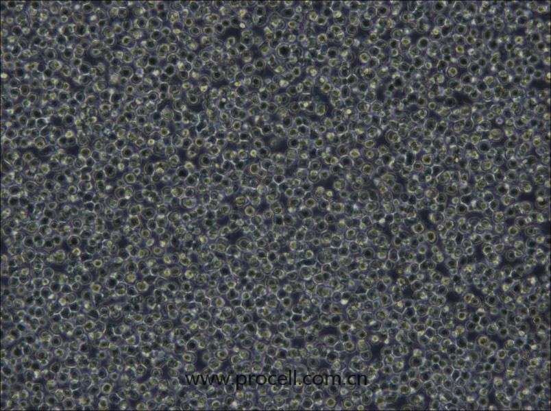 NOMO-1(人白血病細(xì)胞) (STR鑒定正確)