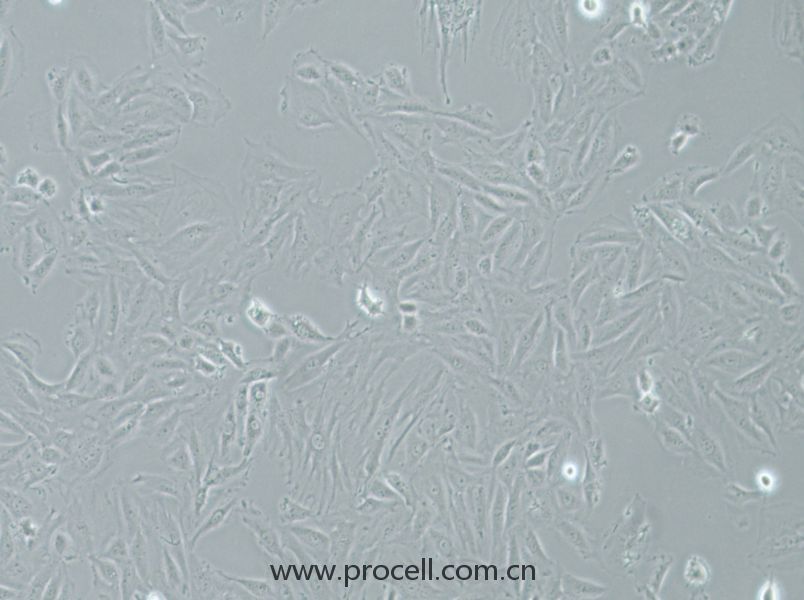 NRK-49F (大鼠正常腎成纖維細胞) (種屬鑒定正確)