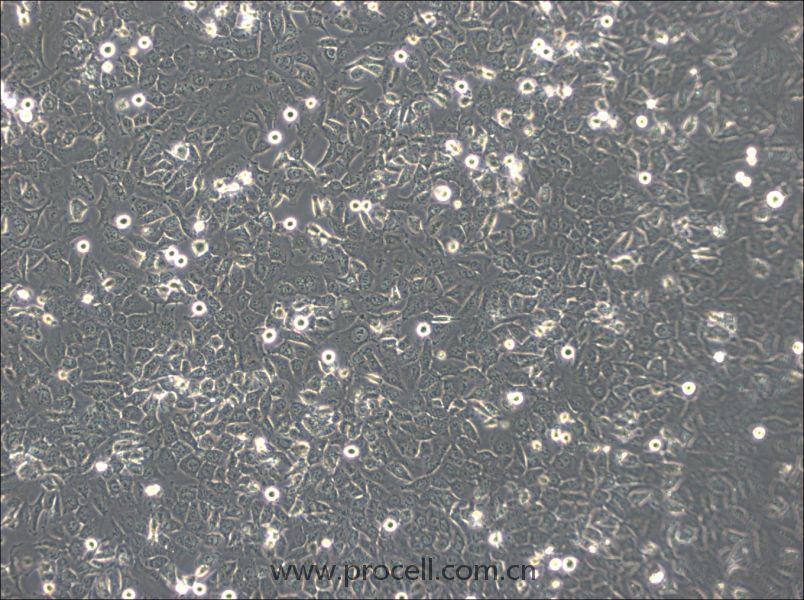 BPH-1 (人前列腺增生細(xì)胞) (STR鑒定正確)