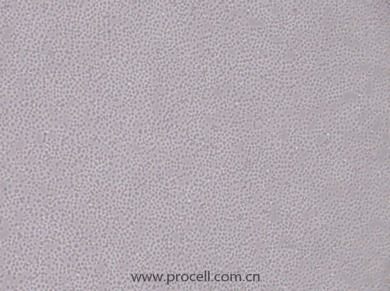 SU-DHL-8 (人B細(xì)胞淋巴瘤細(xì)胞) (STR鑒定正確)