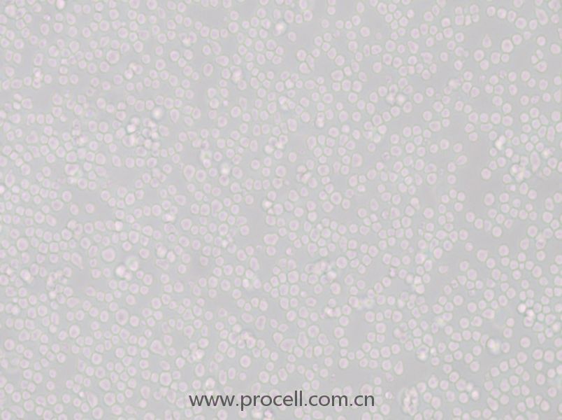 SU-DHL-8 (人B細(xì)胞淋巴瘤細(xì)胞) (STR鑒定正確)