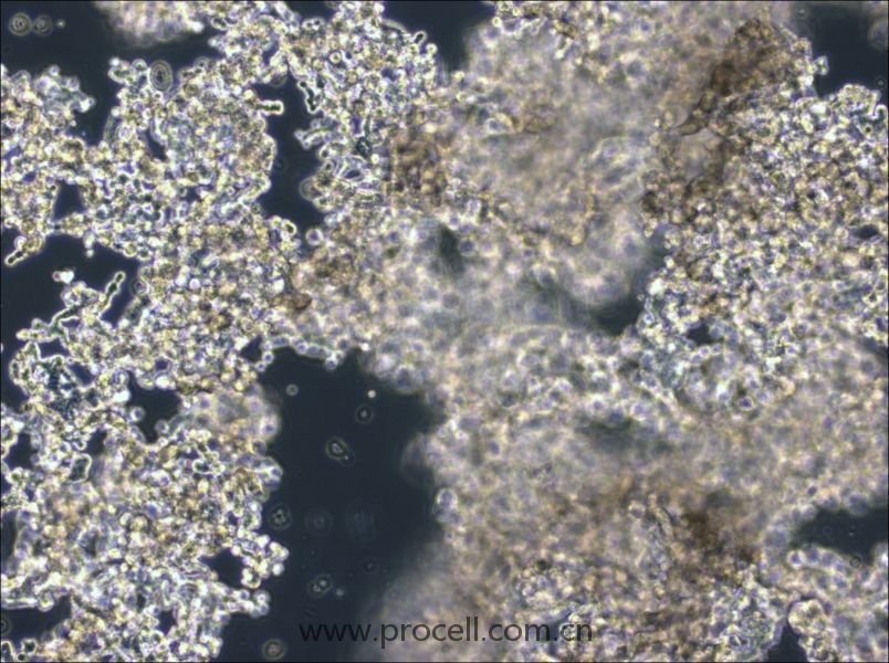 NCI-H526 (人小細胞肺癌細胞) (STR鑒定正確)