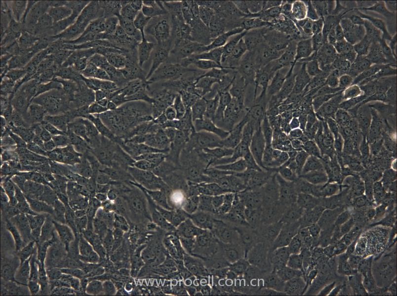 SK-GT-4 (人食道癌腫瘤細(xì)胞) (STR鑒定正確)