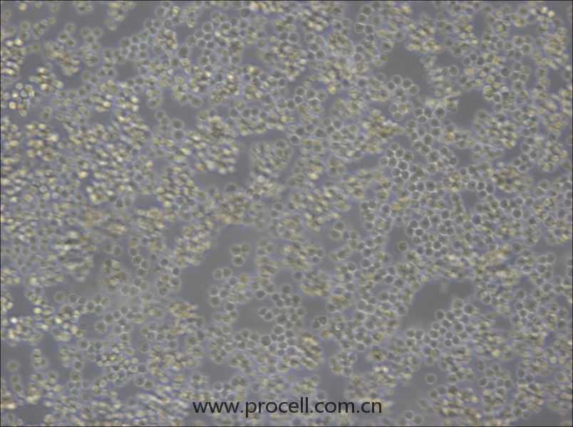 A20 (小鼠B細(xì)胞淋巴瘤) (STR鑒定正確)