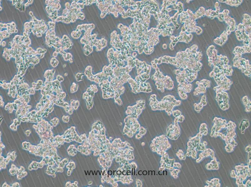 HCC1187(人乳腺導(dǎo)管癌細(xì)胞)(STR鑒定正確)