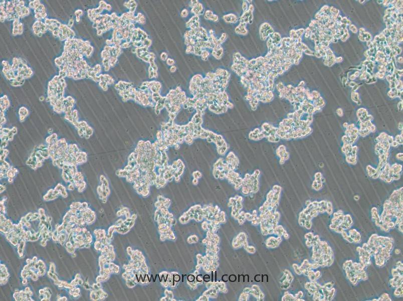 HCC1187(人乳腺導(dǎo)管癌細(xì)胞)(STR鑒定正確)