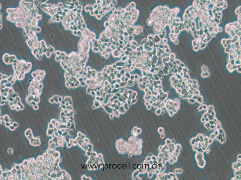 HCC1187(人乳腺導(dǎo)管癌細(xì)胞)(STR鑒定正確)