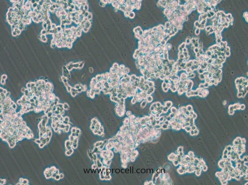 HCC1187(人乳腺導(dǎo)管癌細(xì)胞)(STR鑒定正確)