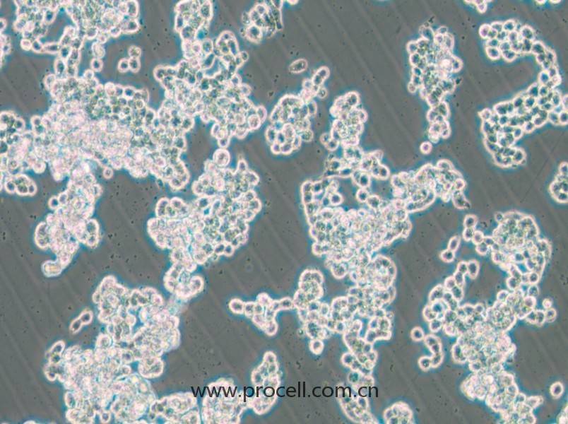 HCC1187(人乳腺導(dǎo)管癌細(xì)胞)(STR鑒定正確)