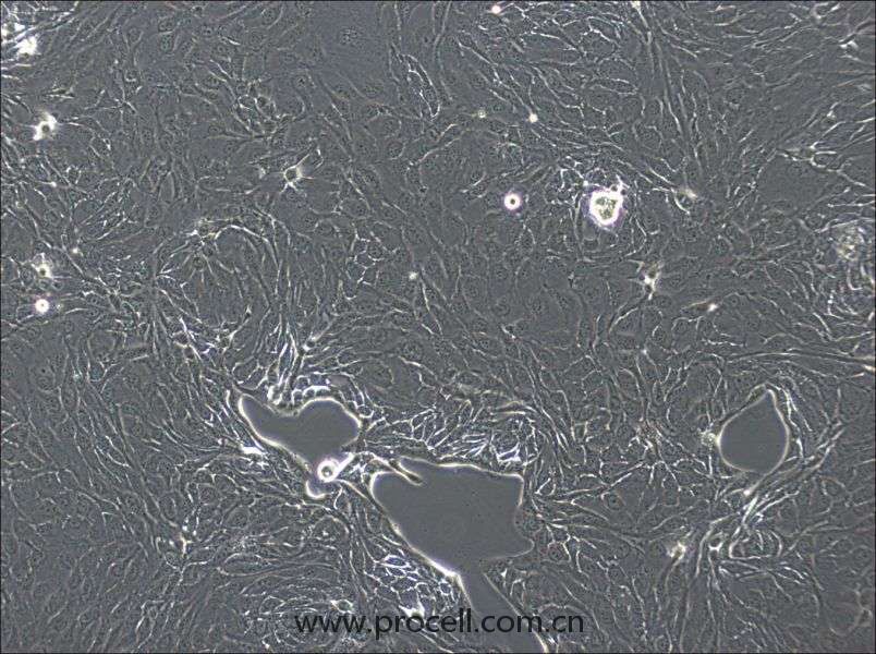 NCI-H2444 (人非小細胞肺癌細胞) (STR鑒定正確)