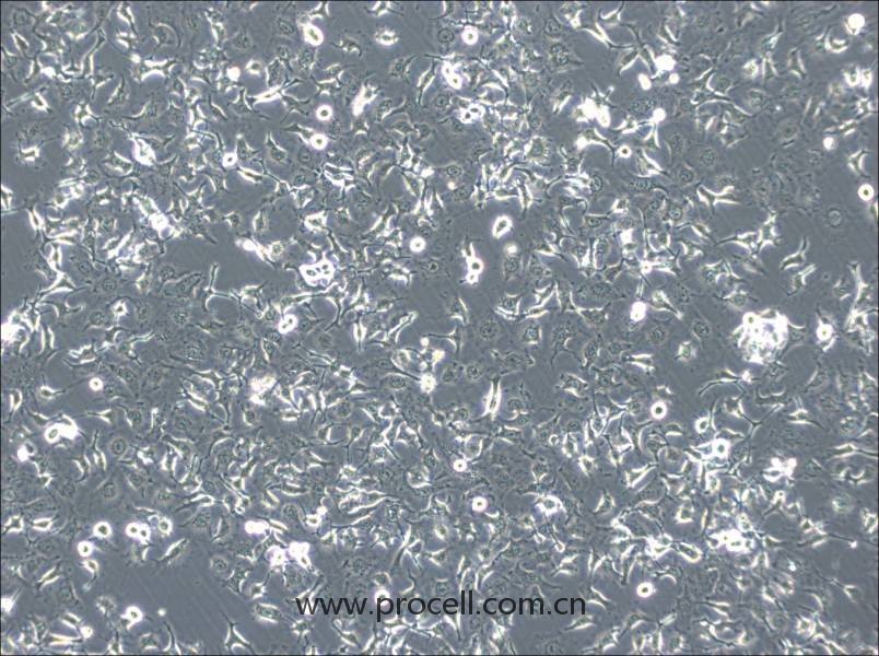 HCC1588(人肺鱗癌細胞) (STR鑒定正確)