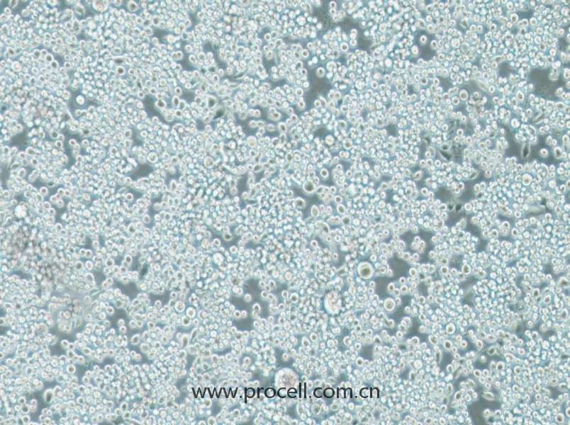 Lu-65(人大細(xì)胞肺癌細(xì)胞) (STR鑒定正確)