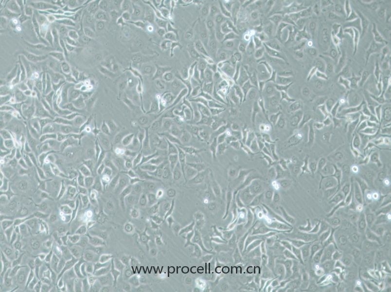 HCC1143 (人乳腺癌細(xì)胞) (STR鑒定正確)