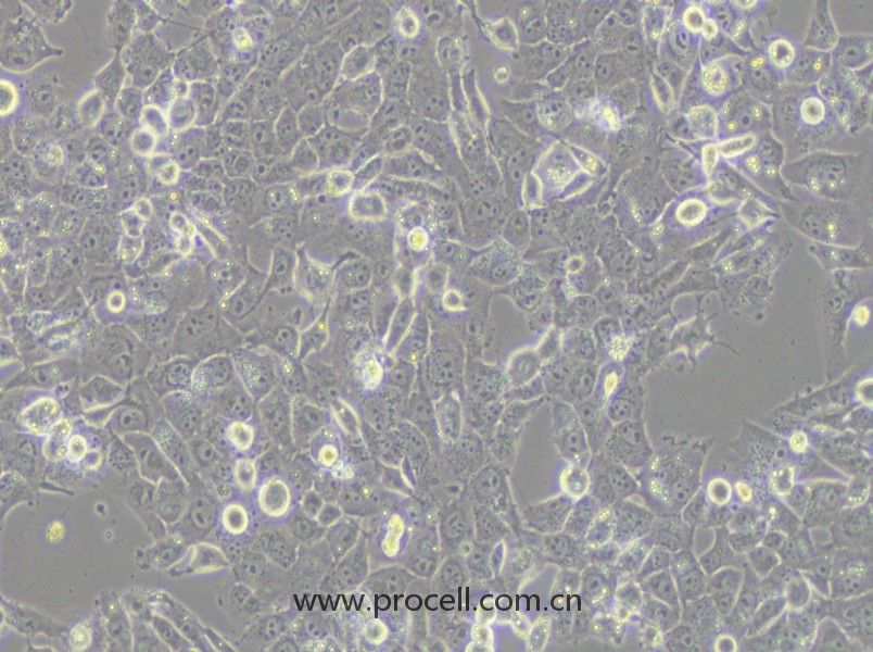NCI-H1915 (人非小細(xì)胞肺癌細(xì)胞) (STR鑒定正確)