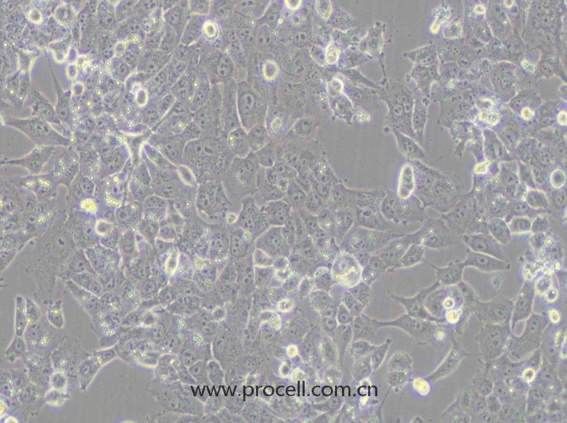 NCI-H1915 (人非小細(xì)胞肺癌細(xì)胞) (STR鑒定正確)