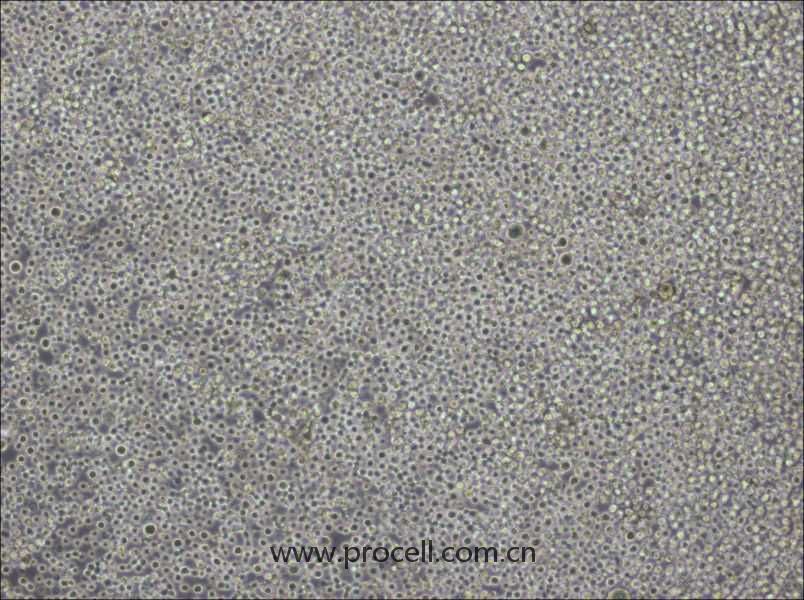 Pfeiffer(人彌漫大B細(xì)胞淋巴瘤細(xì)胞) (STR鑒定正確)