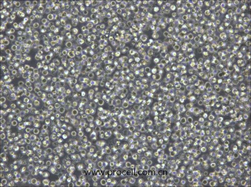 Pfeiffer(人彌漫大B細(xì)胞淋巴瘤細(xì)胞) (STR鑒定正確)