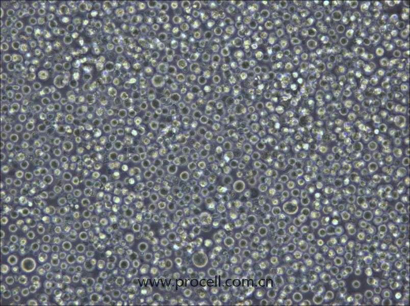 Pfeiffer(人彌漫大B細(xì)胞淋巴瘤細(xì)胞) (STR鑒定正確)