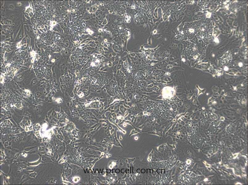 CL-11(人結(jié)腸癌細(xì)胞) (STR鑒定正確)