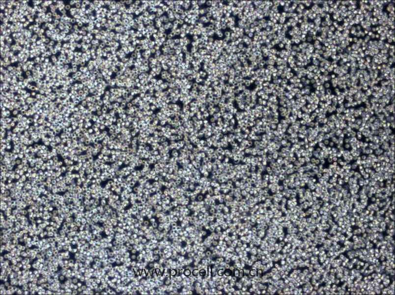 Z-138 (人套細(xì)胞淋巴瘤細(xì)胞) (STR鑒定正確)