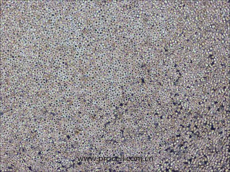 PK136 (小鼠×小鼠雜交瘤細(xì)胞(IgG2a)) (種屬鑒定正確)