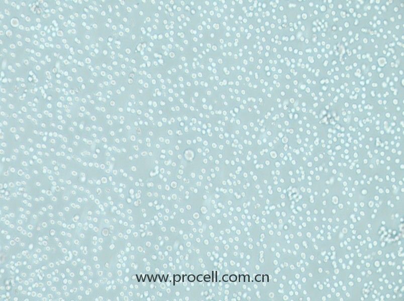 LAMA-84 (人多發(fā)性骨髓瘤細(xì)胞) (STR鑒定正確)