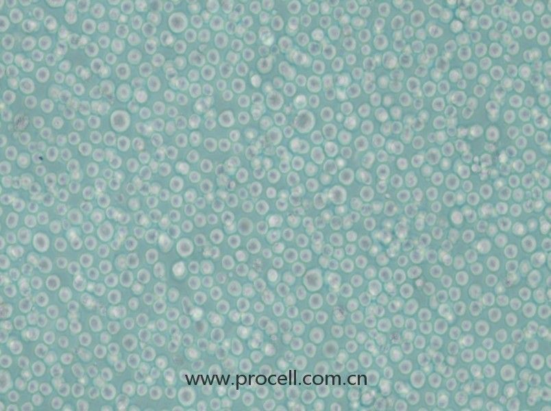 LAMA-84 (人多發(fā)性骨髓瘤細(xì)胞) (STR鑒定正確)